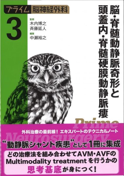 画像1: 【プライム脳神経外科 3】 脳・脊髄動静脈奇形と頭蓋内・脊髄硬膜動静脈瘻 (1)