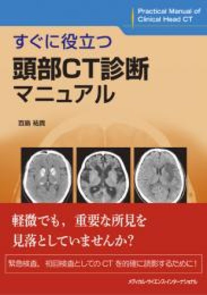 online　shop　すぐに役立つ頭部CT診断マニュアル　メディカルブックサービス