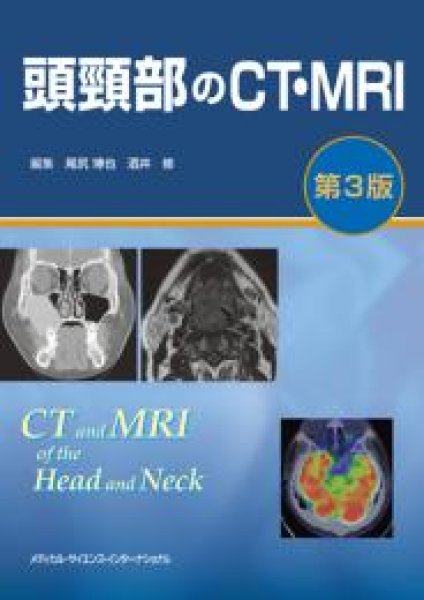 画像1: 頭頸部のCT・MRI　第3版 (1)