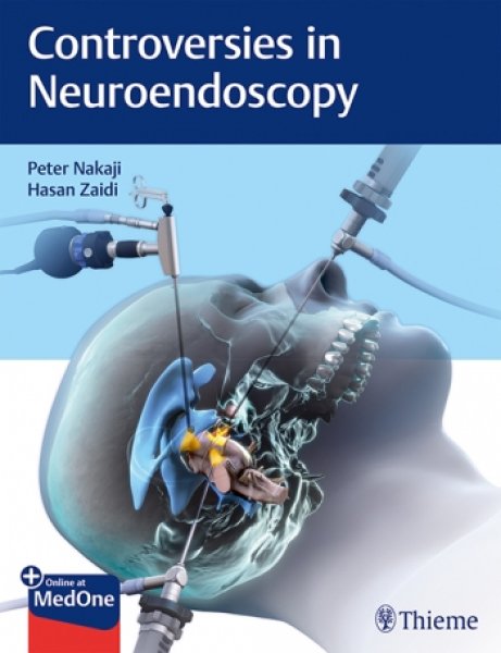 画像1: Controversies in Neuroendoscopy (1)