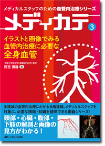 画像1: イラストと画像でみる血管内治療に必要な全身血管 （メディカルスタッフのための血管内治療シリーズ メディカテ 3） (1)