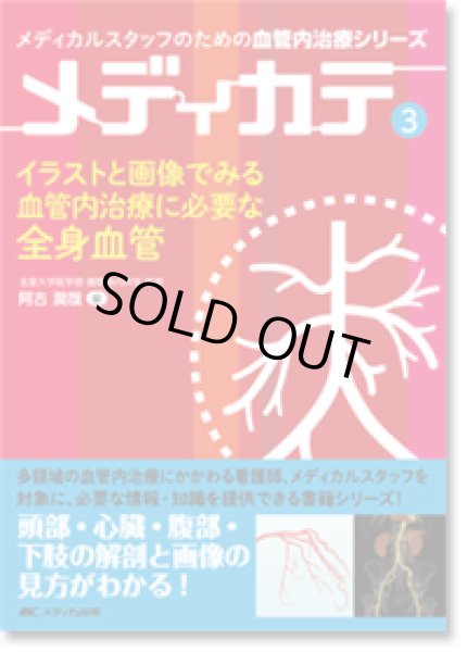 画像1: イラストと画像でみる血管内治療に必要な全身血管 （メディカルスタッフのための血管内治療シリーズ メディカテ 3） (1)