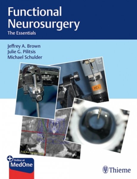 画像1: Functional Neurosurgery: The Essentials (1)