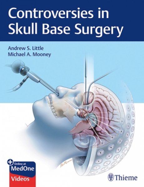 画像1: Controversies in Skull Base Surgery (1)