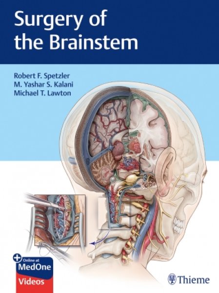 画像1: Surgery of the Brainstem (1)