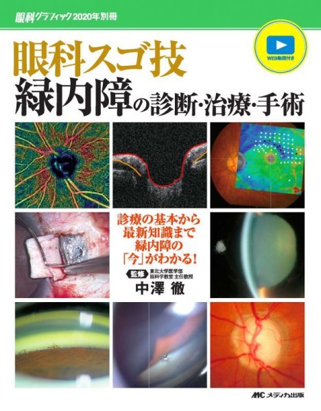 画像1: 眼科スゴ技 緑内障の診断・治療・手術　[眼科グラフィック2020年別冊 ]  (1)