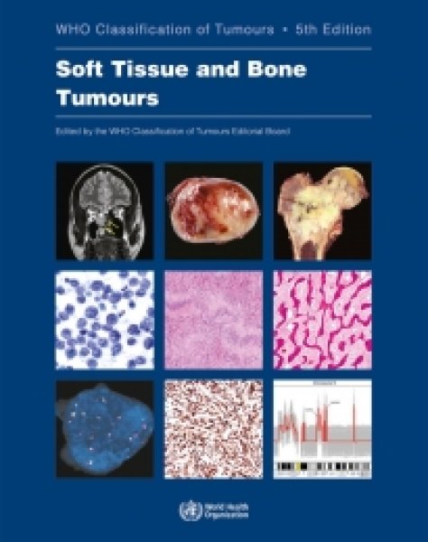 画像1: Soft Tissue and Bone Tumours （WHO Classification of Tumours, 5th Edition, Volume 3） (1)