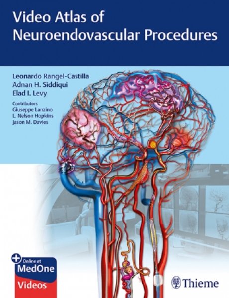 画像1: Video Atlas of Neuroendovascular Procedures (1)