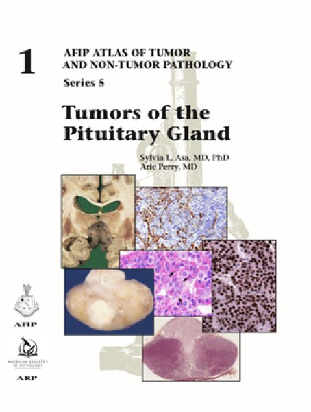 画像1: Tumors of the Pituitary Gland（AFIP Atlas of Tumor & Non-Tumor Pathology, 5th Series,Fascicle 1） (1)