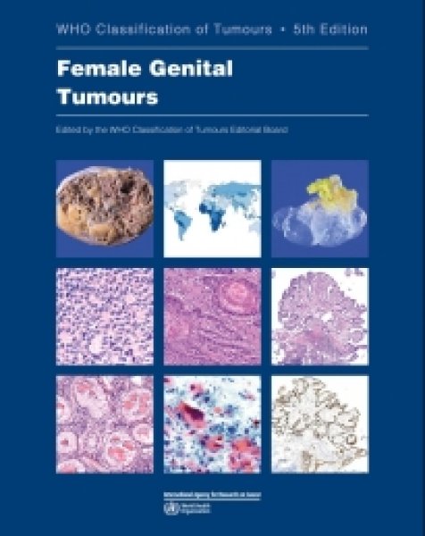 画像1: Female Genital Tumours （WHO Classification of Tumours, 5th Edition, Volume 4） (1)