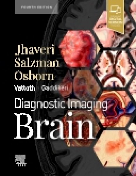 画像1: Diagnostic Imaging: Brain, 4th Edition (1)