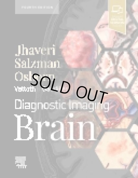 画像1: Diagnostic Imaging: Brain, 4th Edition (1)