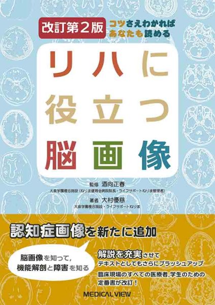 画像1: コツさえわかればあなたも読める  リハに役立つ脳画像 改訂第2版 (1)