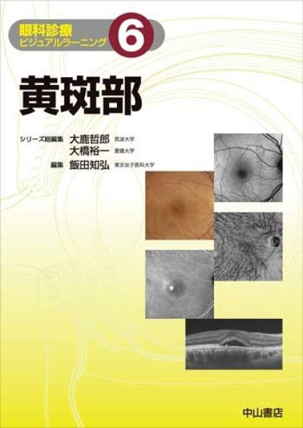 画像1: 黄斑部（眼科診療ビジュアルラーニング　6) (1)
