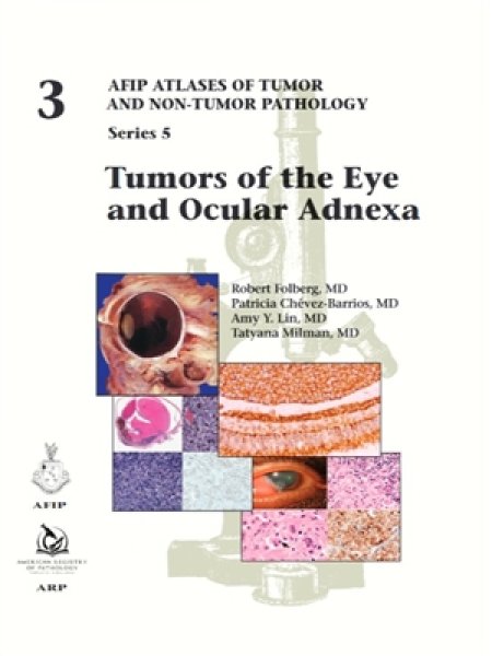 画像1: Tumors of Eye & Ocular Adnexa（AFIP Atlas of Tumor & Non-Tumor Pathology, 5th Series,Fascicle 3） (1)