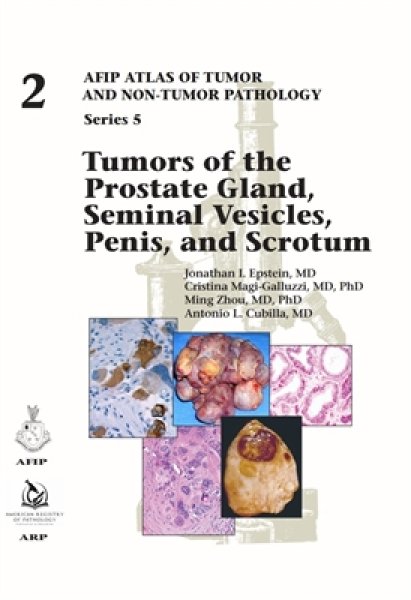 画像1: Tumors of Prostate Gland, Seminal Vesicles, Penis, & Scrotum（AFIP Atlas of Tumor & Non-Tumor Pathology, 5th Series,Fascicle 2） (1)