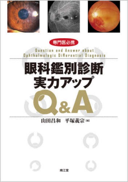 画像1: 専門医必携 眼科鑑別診断実力アップQ&A (1)