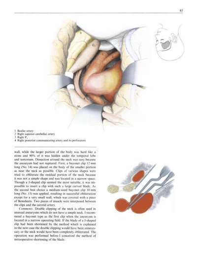 画像2: Sugita,-Microneurosurgical Atlas E-book Edition (電子版）