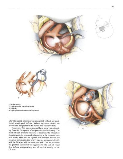 画像1: Sugita,-Microneurosurgical Atlas E-book Edition (電子版）