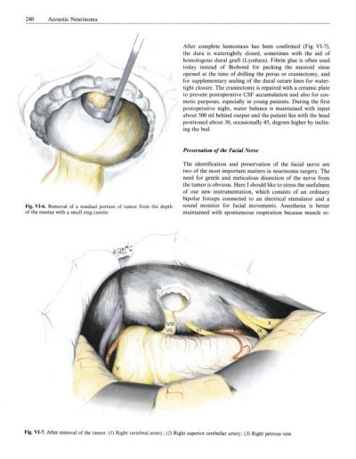 画像3: Sugita,-Microneurosurgical Atlas E-book Edition (電子版）