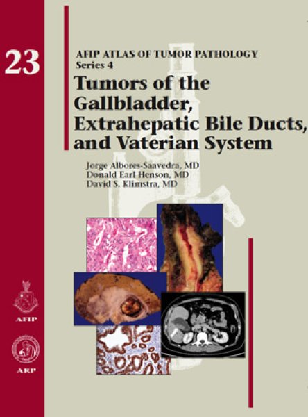 画像1: Tumors of Gallbladder, Extrahepatic Bile Ducts, & Vaterian System（Atlas of Tumor Pathology, Series 4-23） (1)