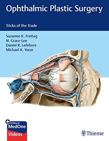 画像1: Ophthalmic Plastic Surgery: Tricks of the Trade (1)