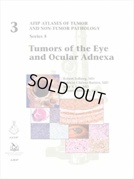 画像1: Tumors of the Eye and Ocular Adnexa（AFIP Atlas of Tumor & Non-Tumor Pathology, 5th Series,Fascicle 3） (1)