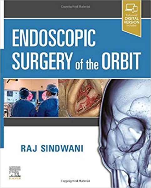 画像1: Endoscopic Surgery of the Orbit (1)