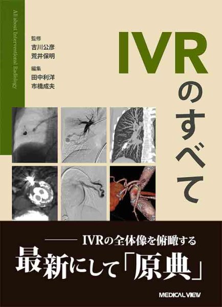 画像1: IVRのすべて (1)