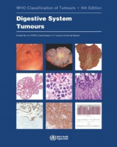 画像1: Digestive System Tumours （WHO Classification of Tumours, 5th Edition, Volume 1） (1)