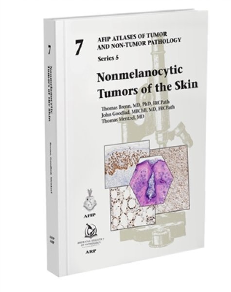 画像1: Nonmelanocytic Tumors of the Skin（AFIP Atlas of Tumor & Non-Tumor Pathology, 5th Series,Fascicle 7） (1)