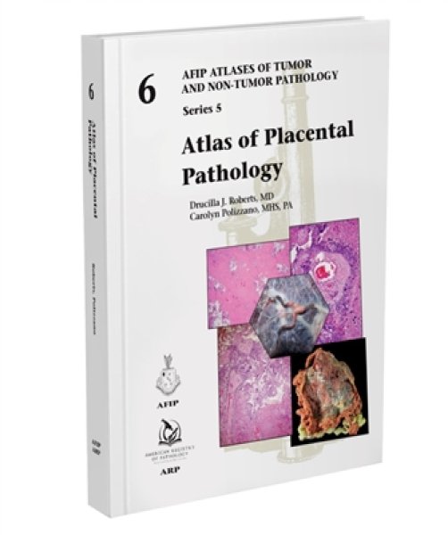 画像1: Atlas of Placental Pathology（AFIP Atlas of Tumor & Non-Tumor Pathology, 5th Series,Fascicle 6） (1)