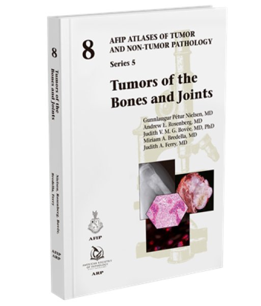 画像1: Tumors of the Bones and Joints （AFIP Atlas of Tumor & Non-Tumor Pathology, 5th Series,Fascicle 8） (1)