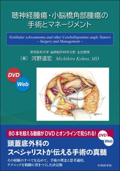画像1: 聴神経腫瘍・小脳橋角部腫瘍の手術とマネージメント (1)