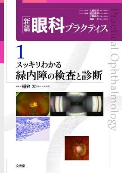 画像1: すっきりわかる緑内障の検査と診断（新編眼科プラクティスシリーズ 1 ） (1)