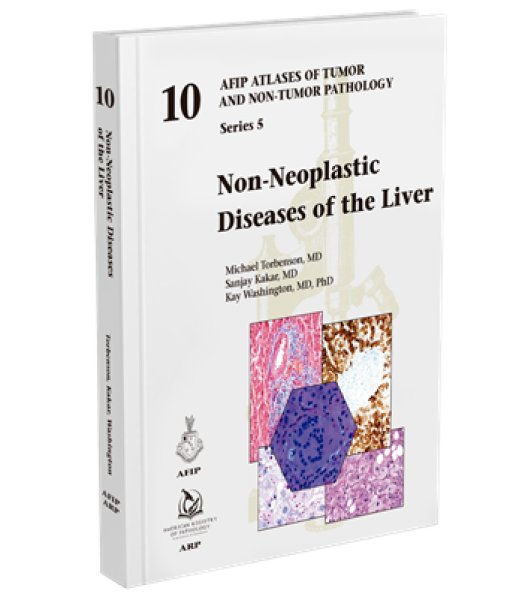 画像1: Non-Neoplastic Diseases of Liver（AFIP Atlas of Tumor & Non-Tumor Pathology, 5th Series,Fascicle 10） (1)