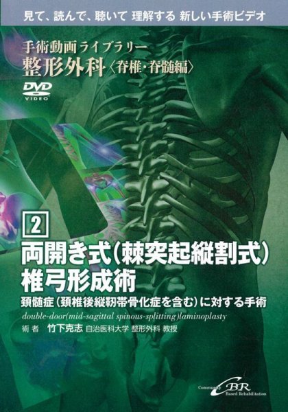 画像1: 【DVD】 両開き式（棘突起縦割式）椎弓形成術　double-door (mid-sagittal spinous-splitting) laminoplasty（手術動画ライブラリー　整形外科〈脊椎・脊髄編(2)〉） (1)