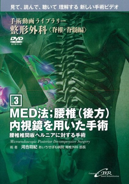 画像1: 【DVD】 MED法；腰椎（後方）内視鏡を用いた手術　Microendoscopic Posterior Decompressive Surgery（手術動画ライブラリー　整形外科〈脊椎・脊髄編(3)〉） (1)