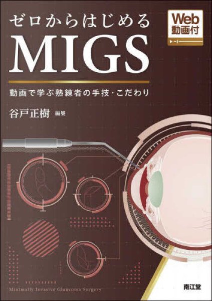 画像1: ゼロからはじめるMIGS［Web動画付］ (1)