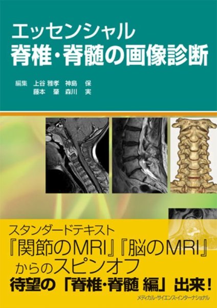 画像1: エッセンシャル脊椎・脊髄の画像診断 (1)