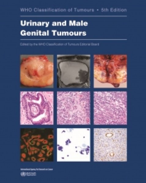 画像1: Urinary and Male Genital Tumours（WHO Classification of Tumours, 5th Edition, Volume 8） (1)