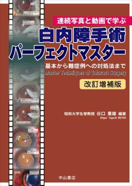 画像1: 連続写真と動画で学ぶ　白内障手術パーフェクトマスター　-基本から難症例への対処法まで-　改訂増補版 (1)