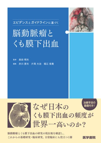 画像1: エビデンスとガイドラインに基づく脳動脈瘤とくも膜下出血 (1)