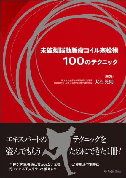 画像1: 未破裂脳動脈瘤コイル塞栓術100のテクニック (1)