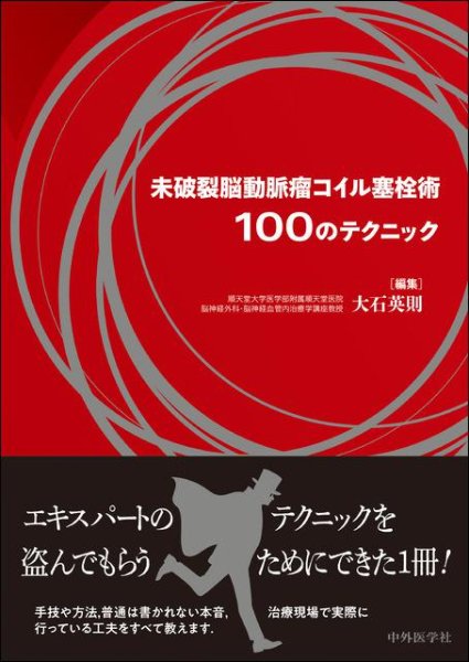 画像1: 未破裂脳動脈瘤コイル塞栓術100のテクニック (1)