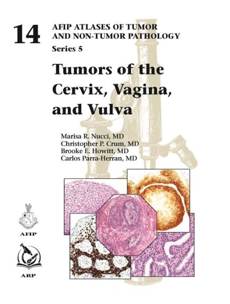 画像1: Tumors of the Cervix, Vagina, and Vulva（AFIP Atlas of Tumor & Non-Tumor Pathology, 5th Series,Fascicle 14） (1)