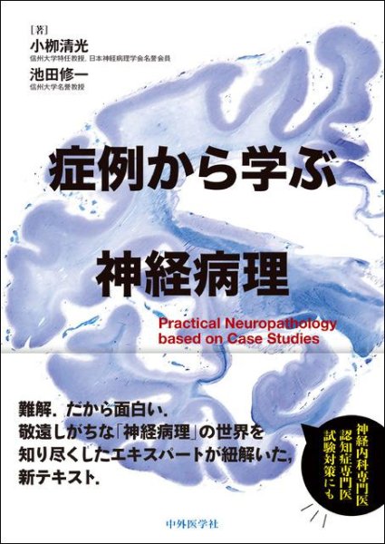 画像1: 症例から学ぶ神経病理 (1)