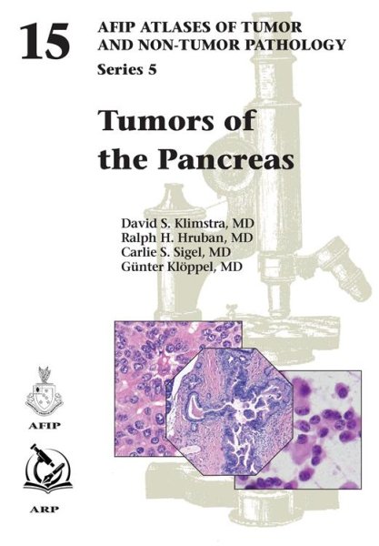 画像1: Tumors of the Pancreas（AFIP Atlas of Tumor & Non-Tumor Pathology, 5th Series,Fascicle 15） (1)