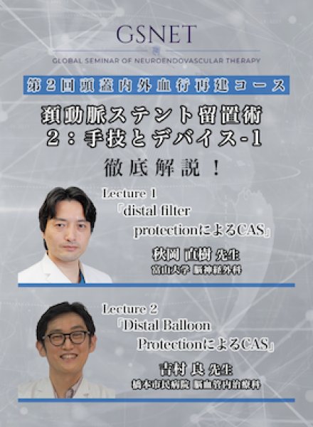 画像1: 動画≫≫≫ GSNET 頭蓋内外血行再建コース2️⃣「頚動脈ステント留置術2：手技とデバイス -1」 (1)