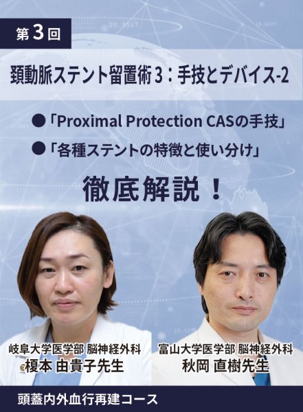 画像1: 動画≫≫≫ GSNET 頭蓋内外血行再建コース3️⃣「頚動脈ステント留置術3：手技とデバイス -2」 (1)